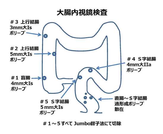 咰i|[v؏j